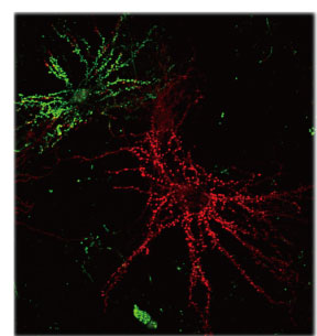 LumiPoreによる隣り合った神経細胞へのターゲティングトランスフェクションの画像