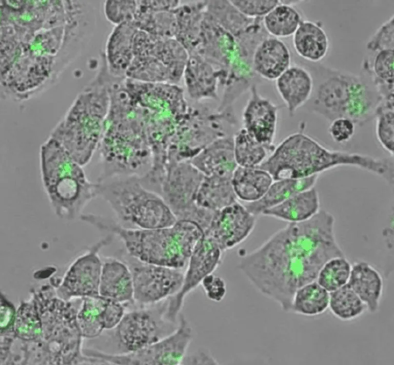 蛍光標識による表現型解析　VRef-63GFP　リファレンスEV CD63-GFP