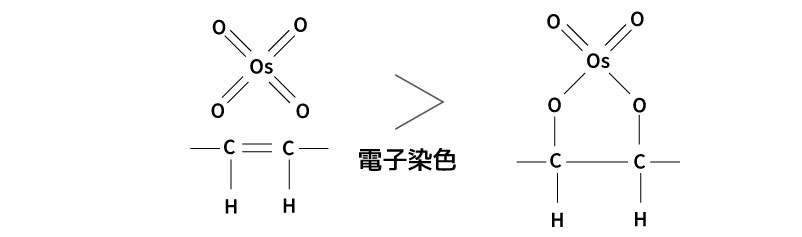 電子染色とは