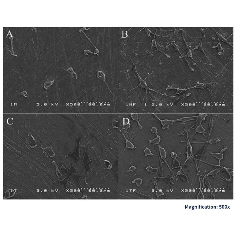 Titanium implant surfaces