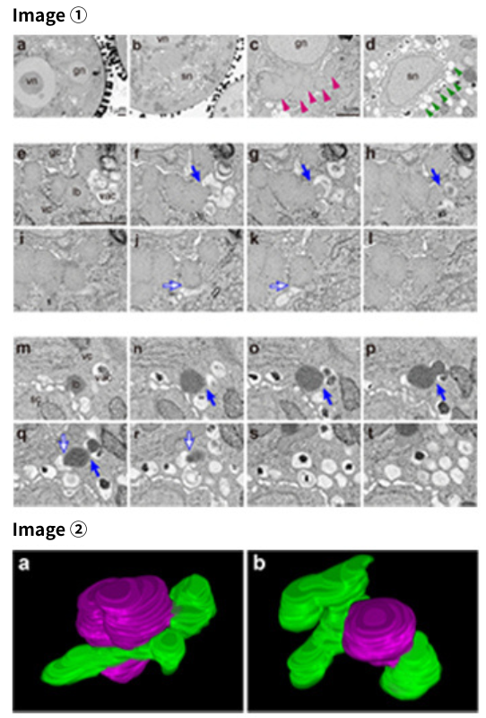 Ultrathin pure osmium coating in serial section SEM (Analysis of microlipophagy during pollen maturation in Arabidopsis thaliana)
